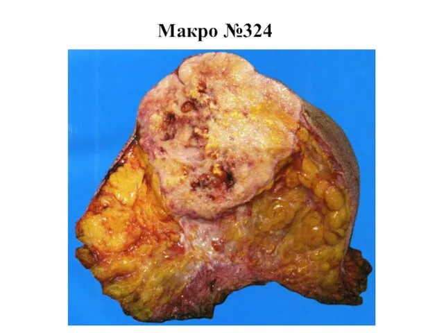 Макро №324