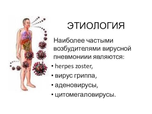 ЭТИОЛОГИЯ Наиболее частыми возбудителями вирусной пневмониии являются: herpes zoster, вирус гриппа, аденовирусы, цитомегаловирусы.