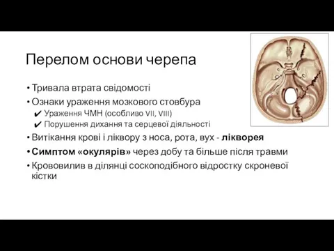 Перелом основи черепа Тривала втрата свідомості Ознаки ураження мозкового стовбура Ураження ЧМН