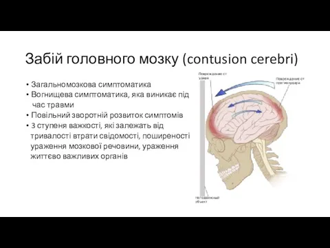 Забій головного мозку (contusion cerebri) Загальномозкова симптоматика Вогнищева симптоматика, яка виникає під