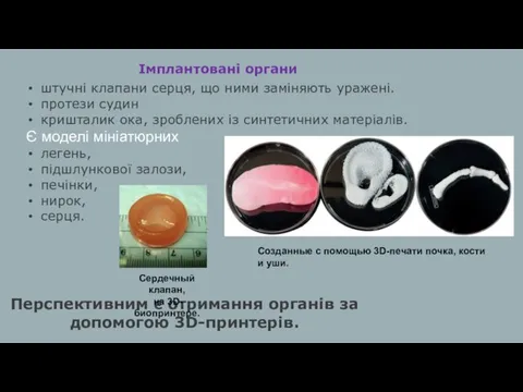 штучні клапани серця, що ними заміняють уражені. протези судин кришталик ока, зроблених