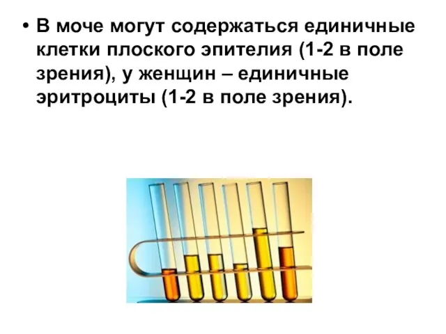 В моче могут содержаться единичные клетки плоского эпителия (1-2 в поле зрения),