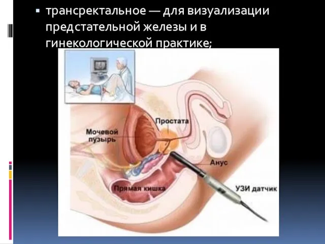 трансректальное — для визуализации предстательной железы и в гинекологической практике;