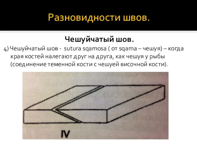 Разновидности швов. Чешуйчатый шов. 4) Чешуйчатый шов - sutura sqamosa ( от