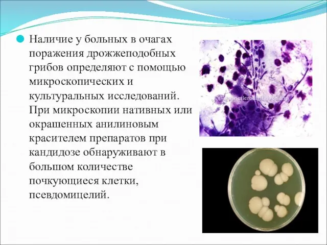 Наличие у больных в очагах поражения дрожжеподобных грибов определяют с помощью микроскопических