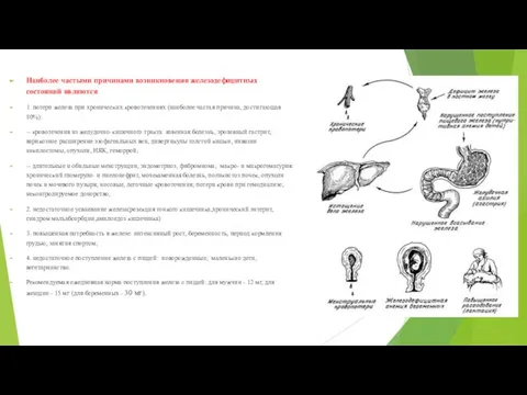 Наиболее частыми причинами возникновения железодефицитных состояний являются: 1. потери железа при хронических