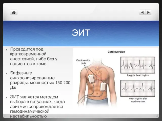 ЭИТ Проводится под кратковременной анестезией, либо без у пациентов в коме Бифазные