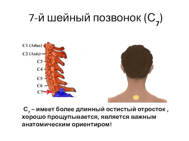 7-й шейный позвонок (С7) С7 – имеет более длинный остистый отросток ,