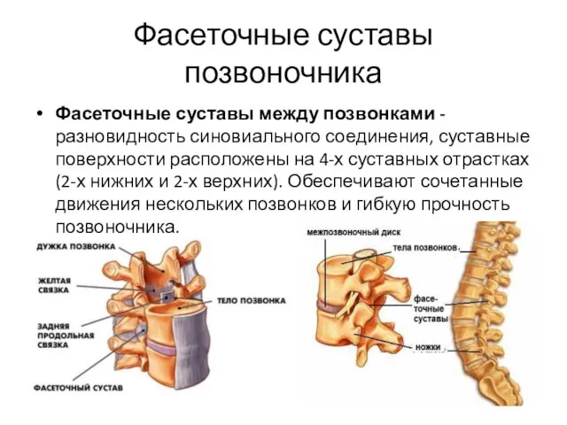 Фасеточные суставы позвоночника Фасеточные суставы между позвонками - разновидность синовиального соединения, суставные