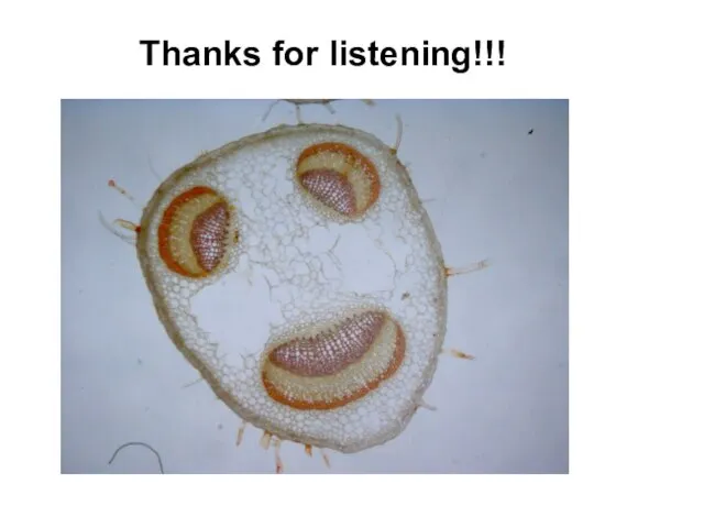 Thanks for listening!!!