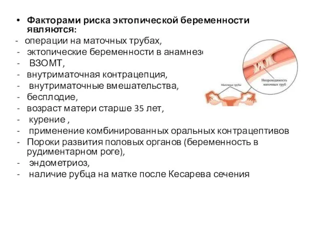 Факторами риска эктопической беременности являются: - операции на маточных трубах, эктопические беременности