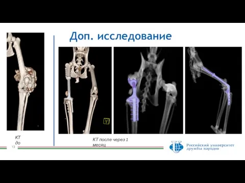 Доп. исследование КТ до КТ после через 1 месяц