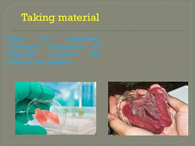 Taking material Taken for subsequent histological examination for diagnostic purposes. The material then register.