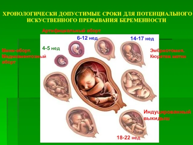 ХРОНОЛОГИЧЕСКИ ДОПУСТИМЫЕ СРОКИ ДЛЯ ПОТЕНЦИАЛЬНОГО ИСКУСТВЕННОГО ПРЕРЫВАНИЯ БЕРЕМЕННОСТИ 4-5 нед 6-12 нед