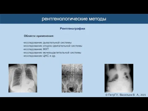 © ПетрГУ, Васильев В. А., 2021 рентгенологические методы Рентгенография Области применения: исследование