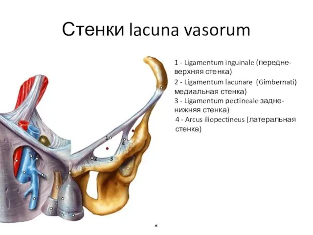 Стенки lacuna vasorum * 1 - Ligamentum inguinale (передне-верхняя стенка) 3 -