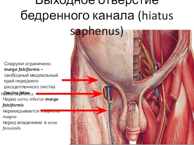 Выходное отверстие бедренного канала (hiatus saphenus) Hiatus saphenus Снаружи ограничено margo falciformis