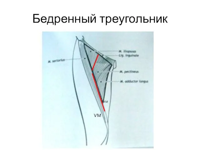 Бедренный треугольник AM VM