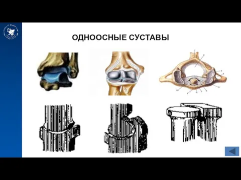 ОДНООСНЫЕ СУСТАВЫ