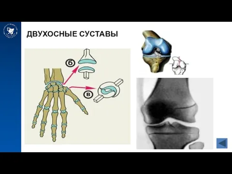 ДВУХОСНЫЕ СУСТАВЫ