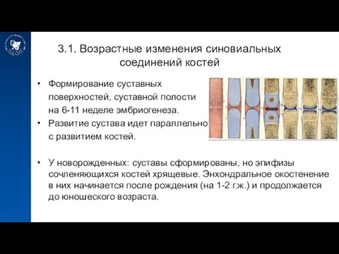 3.1. Возрастные изменения синовиальных соединений костей Формирование суставных поверхностей, суставной полости на