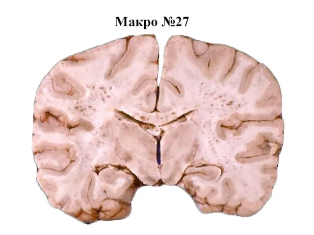 Макро №27