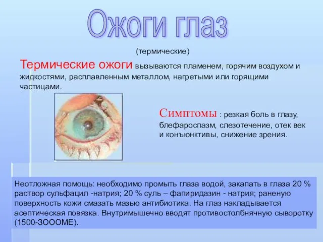 (термические) Термические ожоги вызываются пламенем, горячим воздухом и жидкостями, расплавленным металлом, нагретыми