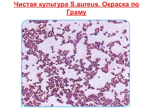 Чистая культура S.aureus. Окраска по Граму