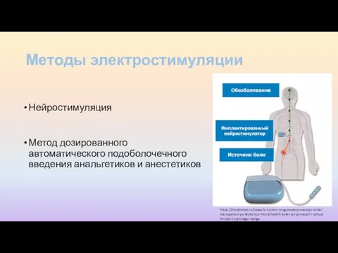 Методы электростимуляции Нейростимуляция Метод дозированного автоматического подоболочечного введения анальгетиков и анестетиков https://moidiabet.ru/news/v-nijnem-novgorode-provodjat-unikalnie-operacii-po-lecheniju-hronicheskih-bolei-pri-pomoschi-neirostimuljacii-spinnogo-mozga