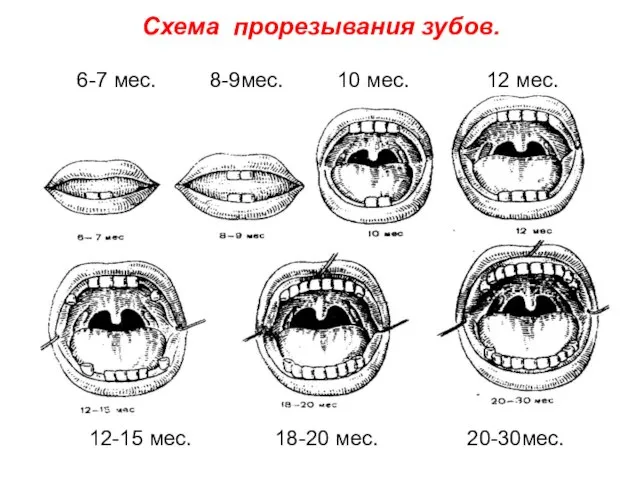 Схема прорезывания зубов. 6-7 мес. 8-9мес. 10 мес. 12 мес. 12-15 мес. 18-20 мес. 20-30мес.
