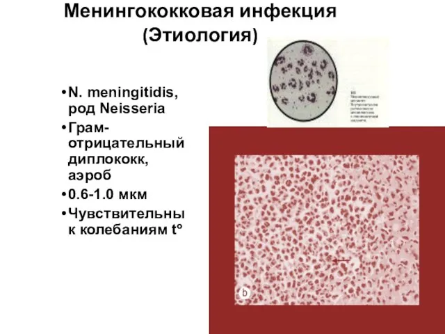 Менингококковая инфекция (Этиология) N. meningitidis, род Neisseria Грам-отрицательный диплококк, аэроб 0.6-1.0 мкм Чувствительны к колебаниям tº