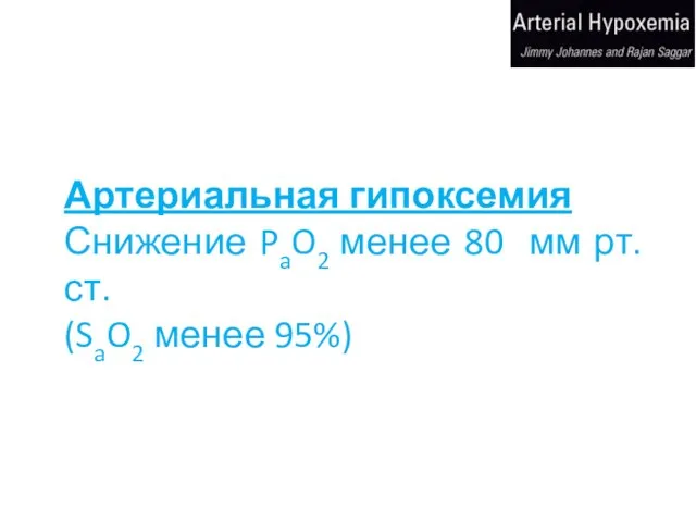 Артериальная гипоксемия Снижение PaO2 менее 80 мм рт.ст. (SaO2 менее 95%)