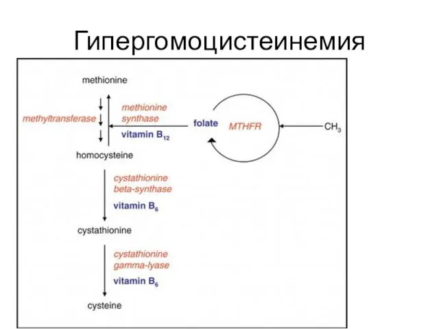 Гипергомоцистеинемия