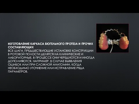 ИЗГОТОВЛЕНИЕ КАРКАСА БЮГЕЛЬНОГО ПРОТЕЗА И ПРОЧИХ СОСТАВЛЯЮЩИХ ВСЕ ШАГИ, ПРЕДШЕСТВУЮЩИЕ УСТАНОВКЕ КОНСТРУКЦИИ