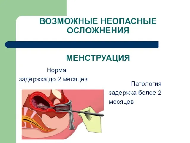 ВОЗМОЖНЫЕ НЕОПАСНЫЕ ОСЛОЖНЕНИЯ МЕНСТРУАЦИЯ Норма задержка до 2 месяцев Патология задержка более 2 месяцев