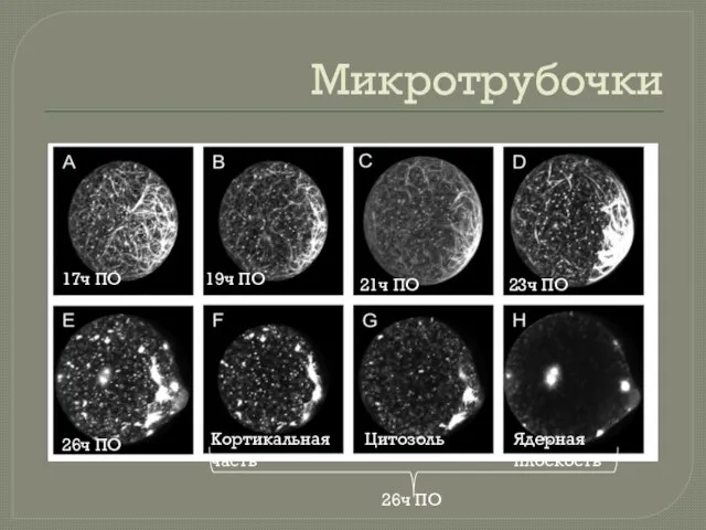 Микротрубочки 17ч ПО 19ч ПО 21ч ПО 23ч ПО 26ч ПО 26ч