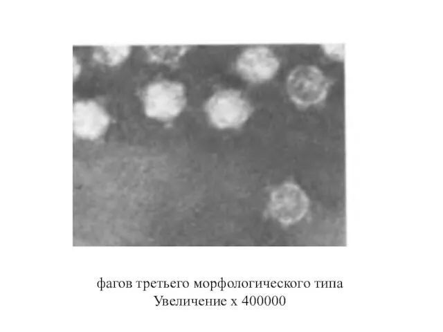 фагов третьего морфологического типа Увеличение х 400000