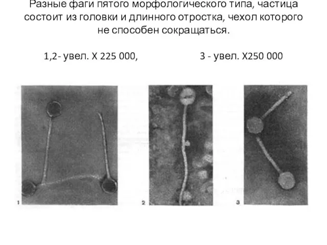 Разные фаги пятого морфологического типа, частица состоит из головки и длинного отростка,