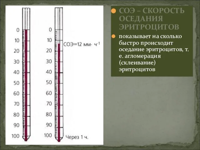 СОЭ – СКОРОСТЬ ОСЕДАНИЯ ЭРИТРОЦИТОВ показывает на сколько быстро происходит оседание эритроцитов, т.е. агломерация (склеивание) эритроцитов