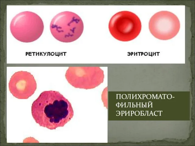 ПОЛИХРОМАТО-ФИЛЬНЫЙ ЭРИРОБЛАСТ