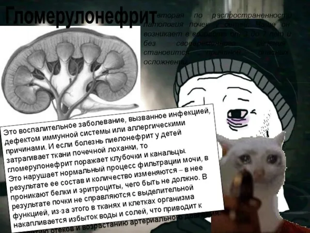 – вторая по распространенности патология почек у детей. Чаще он возникает в