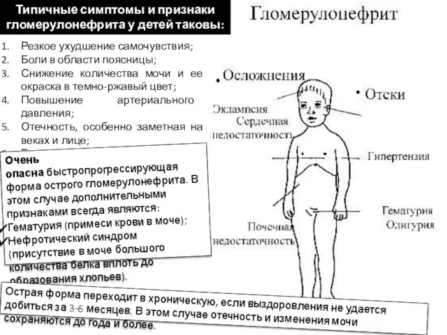 Типичные симптомы и признаки гломерулонефрита у детей таковы: Резкое ухудшение самочувствия; Боли