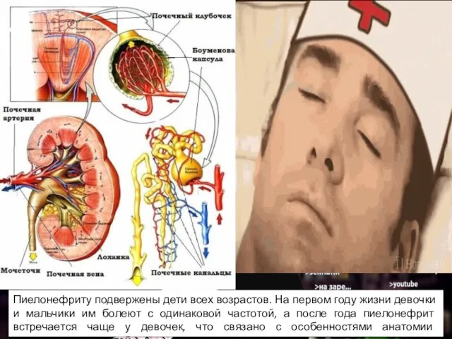 Пиелонефриту подвержены дети всех возрастов. На первом году жизни девочки и мальчики