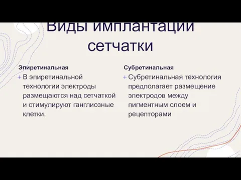 Виды имплантации сетчатки Эпиретинальная В эпиретинальной технологии электроды размещаются над сетчаткой и