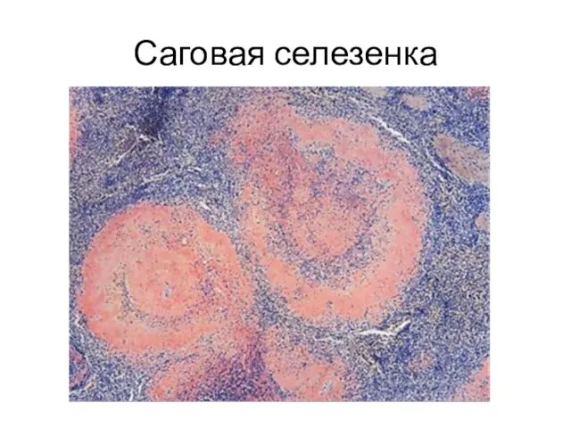 Саговая селезенка