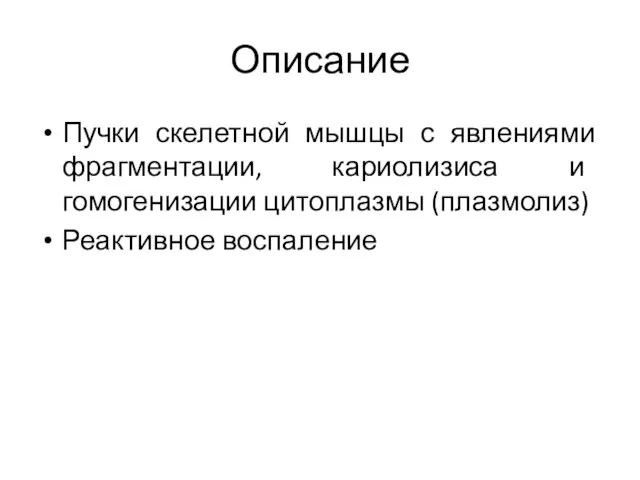 Описание Пучки скелетной мышцы с явлениями фрагментации, кариолизиса и гомогенизации цитоплазмы (плазмолиз) Реактивное воспаление