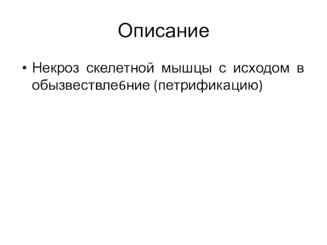 Описание Некроз скелетной мышцы с исходом в обызвествле6ние (петрификацию)