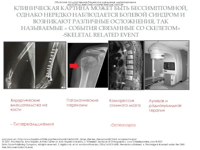 КЛИНИЧЕСКАЯ КАРТИНА МОЖЕТ БЫТЬ БЕССИМПТОМНОЙ, ОДНАКО НЕРЕДКО НАБЛЮДАЕТСЯ БОЛЕВОЙ СИНДРОМ И ВОЗНИКАЮТ