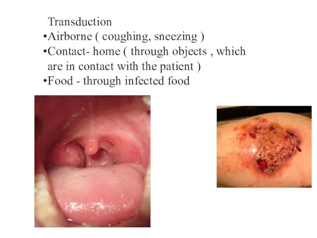 Transduction Airborne ( coughing, sneezing ) Contact- home ( through objects ,