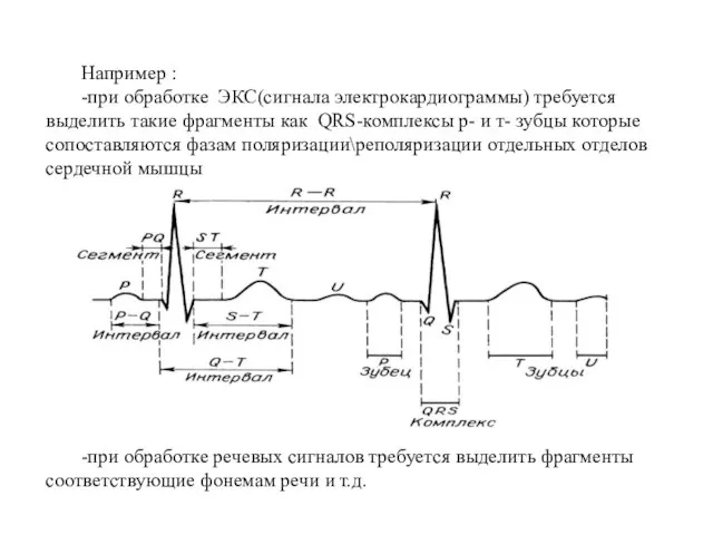 Например : -при обработке ЭКС(сигнала электрокардиограммы) требуется выделить такие фрагменты как QRS-комплексы